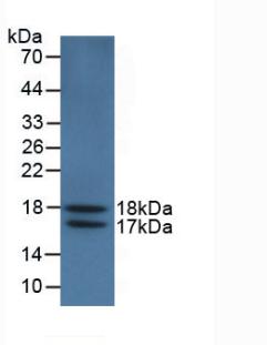 Monoclonal Antibody to Vascular Endothelial Growth Factor 121 (VEGF121)