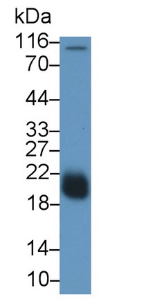 Monoclonal Antibody to Lectin Like Oxidized Low Density Lipoprotein Receptor 1 (LOX1)