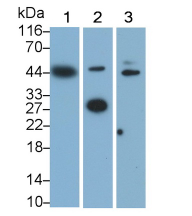 Monoclonal Antibody to Lectin Like Oxidized Low Density Lipoprotein Receptor 1 (LOX1)