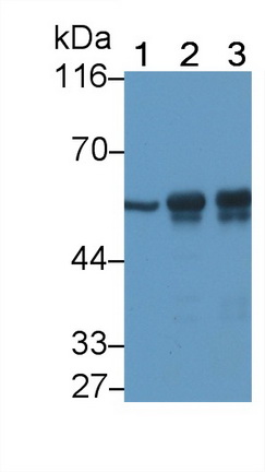 Monoclonal Antibody to Tubulin Beta (TUBb)