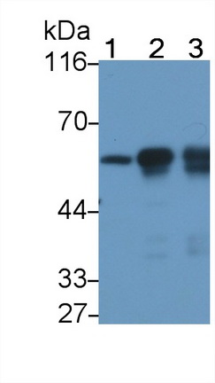 Monoclonal Antibody to Tubulin Beta (TUBb)