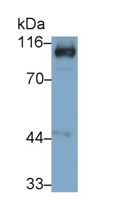 Monoclonal Antibody to Angiotensin I Converting Enzyme 2 (ACE2)