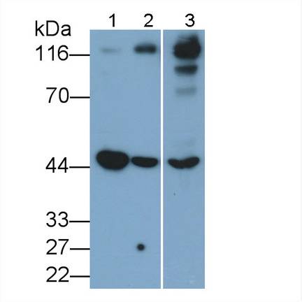 Monoclonal Antibody to Angiotensin I Converting Enzyme 2 (ACE2)