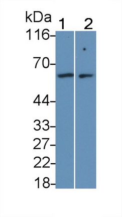 Monoclonal Antibody to Interleukin 7 Receptor (IL7R)