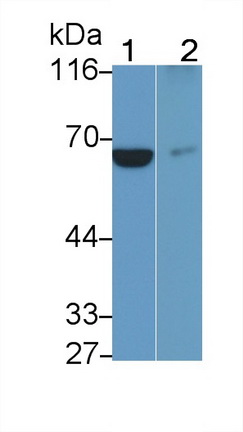 Monoclonal Antibody to Interleukin 7 Receptor (IL7R)