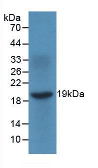 Monoclonal Antibody to Monokine Induced By Interferon Gamma (MIg)