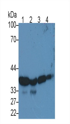 Monoclonal Antibody to Glyceraldehyde-3-Phosphate Dehydrogenase (GAPDH)