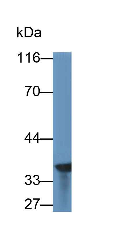 Monoclonal Antibody to Glyceraldehyde-3-Phosphate Dehydrogenase (GAPDH)