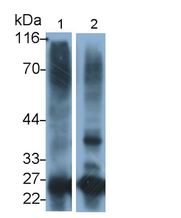 Monoclonal Antibody to Cathepsin S (CTSS)