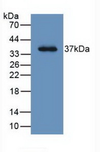 Monoclonal Antibody to Leucine Rich Alpha-2-Glycoprotein 1 (LRG1)