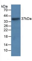 Monoclonal Antibody to Leucine Rich Alpha-2-Glycoprotein 1 (LRG1)