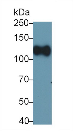 Monoclonal Antibody to Cluster Of Differentiation 34 (CD34)