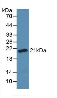 Monoclonal Antibody to Superoxide Dismutase 1 (SOD1)