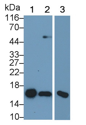 Monoclonal Antibody to Superoxide Dismutase 1 (SOD1)