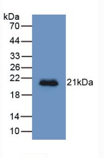 Monoclonal Antibody to Hemojuvelin (HJV)