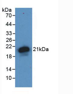 Monoclonal Antibody to Hemojuvelin (HJV)