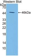 Monoclonal Antibody to Apolipoprotein A5 (APOA5)