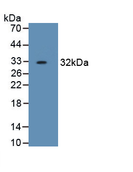 Monoclonal Antibody to Haptoglobin Related Protein (HPR)