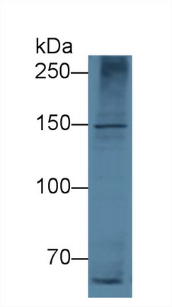 Monoclonal Antibody to Apolipoprotein B (APOB)