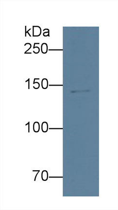 Monoclonal Antibody to Apolipoprotein B (APOB)