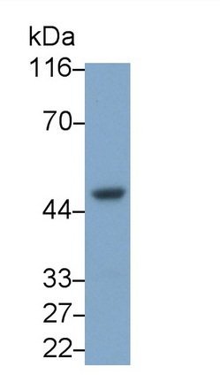 Monoclonal Antibody to Interleukin 8 Receptor Beta (IL8Rb)