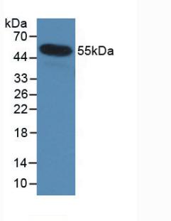 Monoclonal Antibody to Interleukin 35 (IL35)