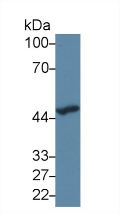 Monoclonal Antibody to Serpin A10 (SERPINA10)