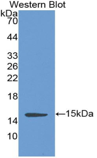 Monoclonal Antibody to Complement Factor B (CFB)
