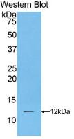 Monoclonal Antibody to S100 Calcium Binding Protein A5 (S100A5)