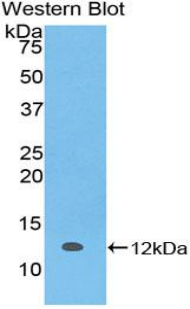 Monoclonal Antibody to S100 Calcium Binding Protein A5 (S100A5)