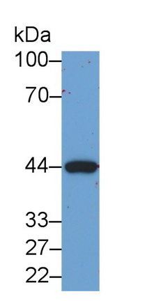 Monoclonal Antibody to Creatine Kinase B (CK-BB)