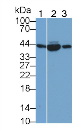 Monoclonal Antibody to Creatine Kinase B (CK-BB)