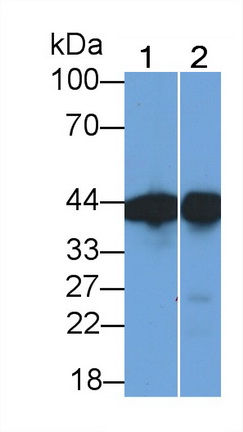 Monoclonal Antibody to Creatine Kinase B (CK-BB)