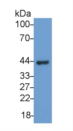 Monoclonal Antibody to Creatine Kinase B (CK-BB)