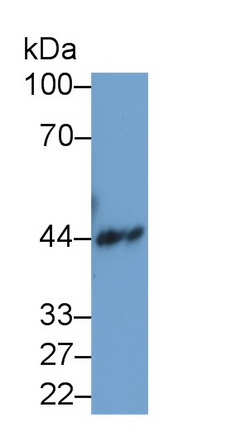 Monoclonal Antibody to Creatine Kinase B (CK-BB)