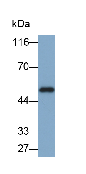 Monoclonal Antibody to Creatine Kinase B (CK-BB)