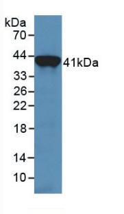 Monoclonal Antibody to Transferrin (TF)