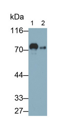 Monoclonal Antibody to Transferrin (TF)