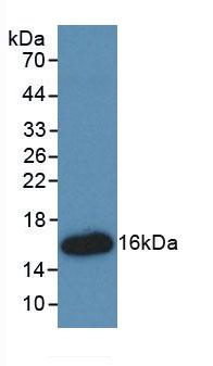 Monoclonal Antibody to High Mobility Group AT Hook Protein 1 (HMGA1)