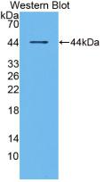 Monoclonal Antibody to Receptor Activator Of Nuclear Factor Kappa B (RANk)