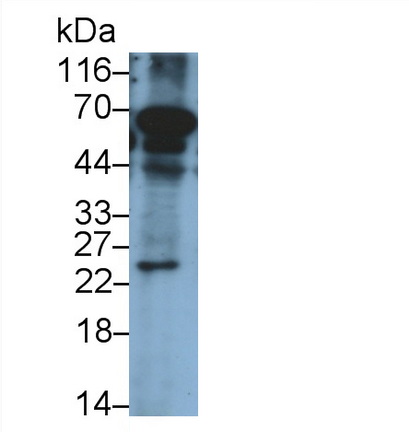 Monoclonal Antibody to Interleukin 24 (IL24)