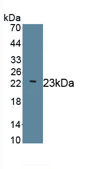 Monoclonal Antibody to Laminin Gamma 2 (LAMC2)