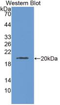 Monoclonal Antibody to Laminin Gamma 3 (LAMC3)