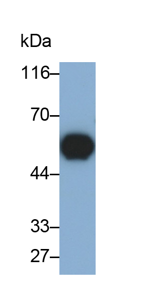 Monoclonal Antibody to SMAD family member 3 (SMAD3)