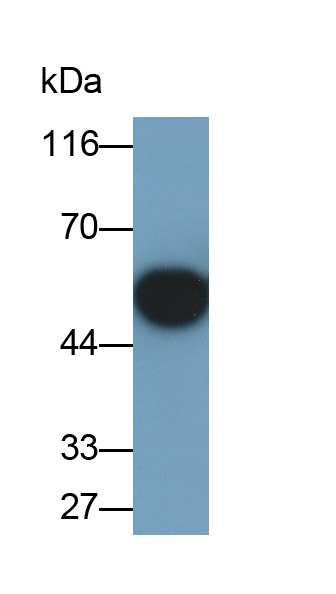 Monoclonal Antibody to SMAD family member 3 (SMAD3)