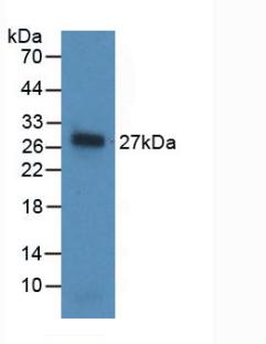 Monoclonal Antibody to Noggin (NOG)