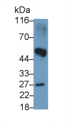 Monoclonal Antibody to Noggin (NOG)