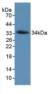 Monoclonal Antibody to Collagen Type VII (COL7)