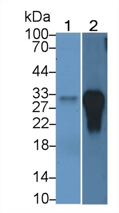 Monoclonal Antibody to HLA Class II Histocompatibility Antigen, DRB1 Beta Chain (HLA-DRB1)