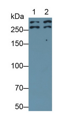 Monoclonal Antibody to Desmoplakin (DSP)